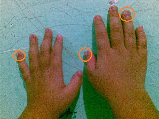 6+ Arti Mimpi Kuku Ibu Jari Tangan Copot