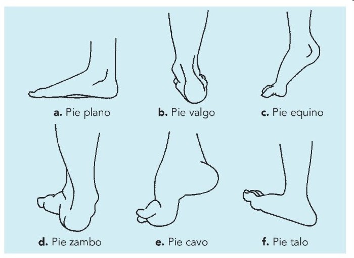 blog_diana Colocación de pies
