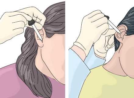 Administering Ear Drops Va Happy