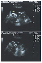 20 Week Ultrasound