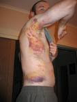 Ouch!