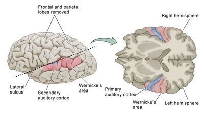auditory cortex located auditory cortex located