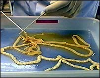 tapeworm tapeworms human tape worm diet long grow worms body bmp infestation causes symptoms sued foot chicago restaurant parasites bodysnatchers