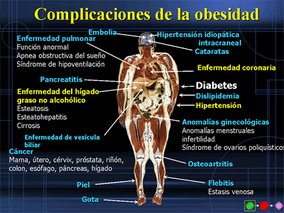 La prevención del cáncer (folleto informativo)