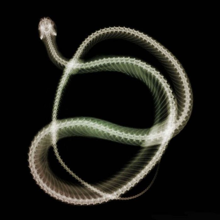 Xray photoshop ~ Alpin Funny Picture!!