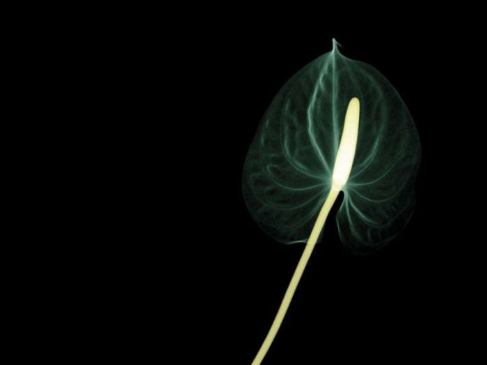 Xray photoshop ~ Alpin Funny Picture!!