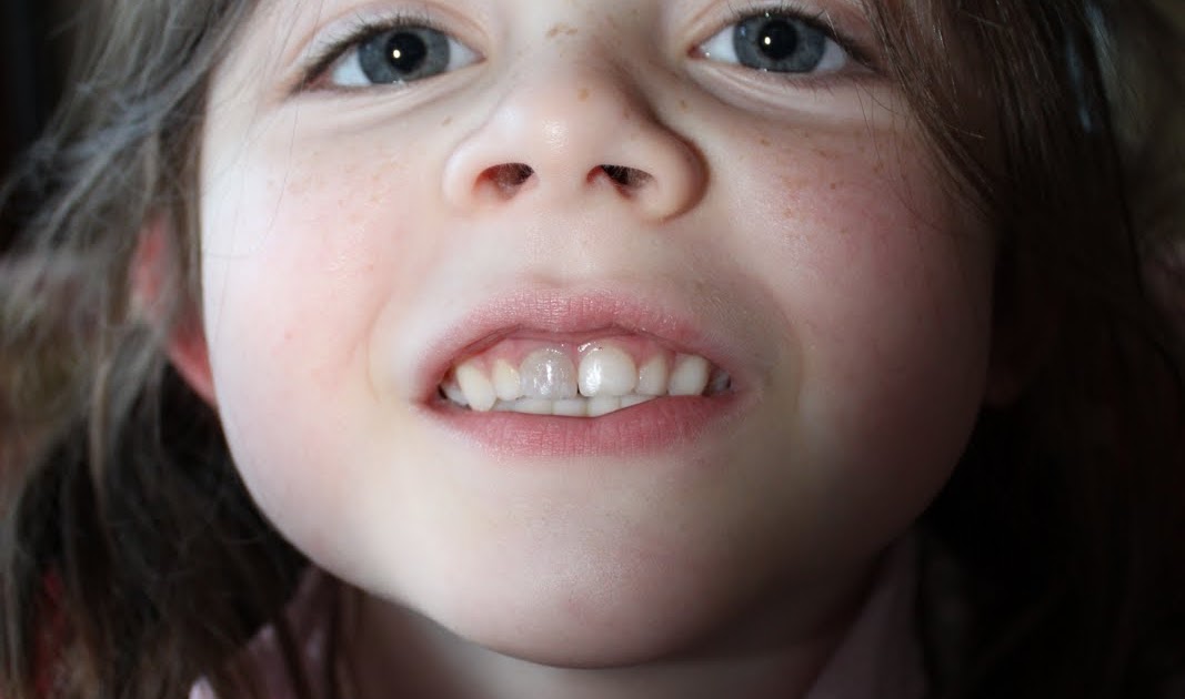 Koinonia the gray tooth