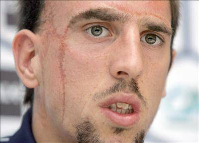 Ribery hablo sobre Francia