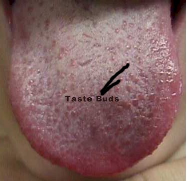 Vitamin Deficiency Tongue