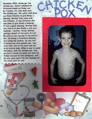 chicken pox. when he had chicken pox. chicken pox. when he had