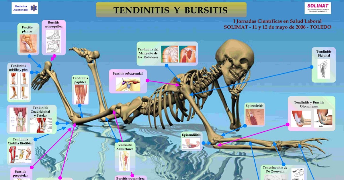 CLINICA 2000: Poster 2006