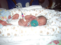 Jaxson- 1 week old