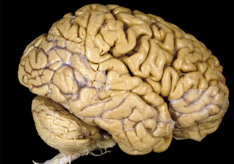 [human-brain.jpg]