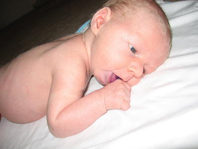 heat rashes on abies. heat pictures of heat rash on babies. heat rashes on abies. heat