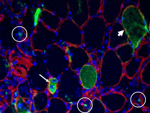 Exogenous gene expression in regenerating muscle