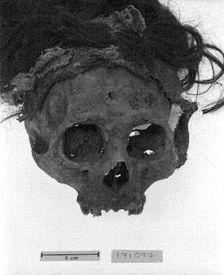 Nasca trophy head from a tomb at the site of Cahuachi (Field Museum 1694.170150) 