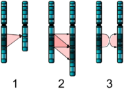 ASD and the chromosomal mutations!