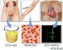 Hypertension tests