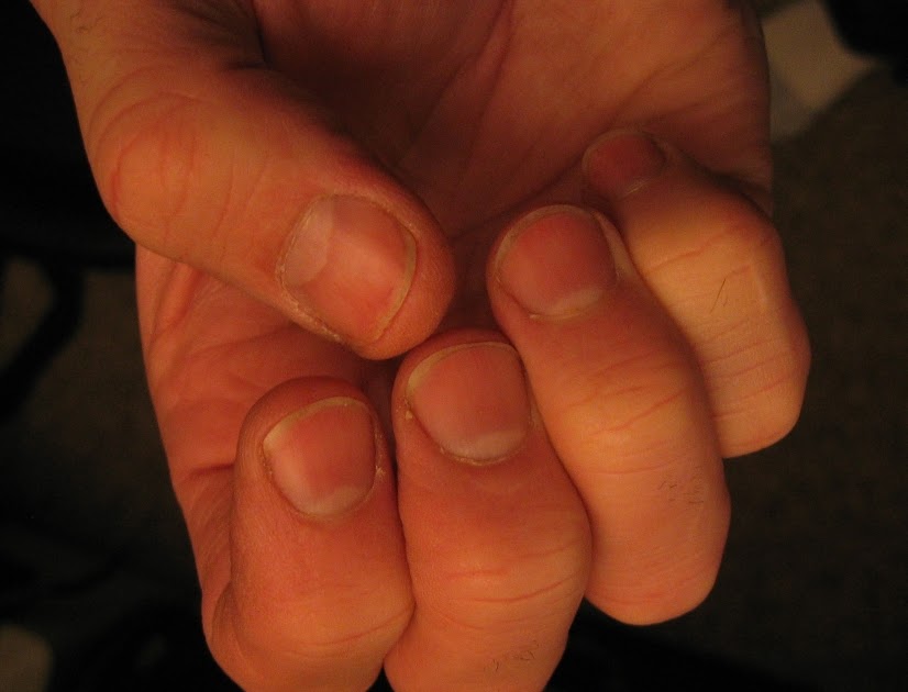 Old Enough to Know Better Busted Fingernail Blues