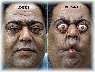 Como eo exame de prostata