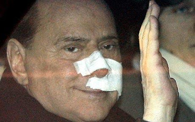 Silvio Berlusconi leaves hospital