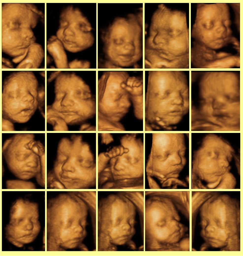 RADİSTANBUL GÖRÜNTÜLEME VE DİŞ TOMOGRAFİSİ MERKEZİ 02165218836