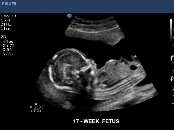 ÇEKAP TEŞHİS VE TANI GÖRÜNTÜLEME MERKEZİ RADİSTANBUL 02165218836 0