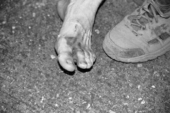 What does a one-day, 100-mile, trail run across the High Sierra do to your feet?