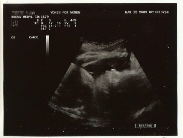 [scan_9312165545_1.jpg]