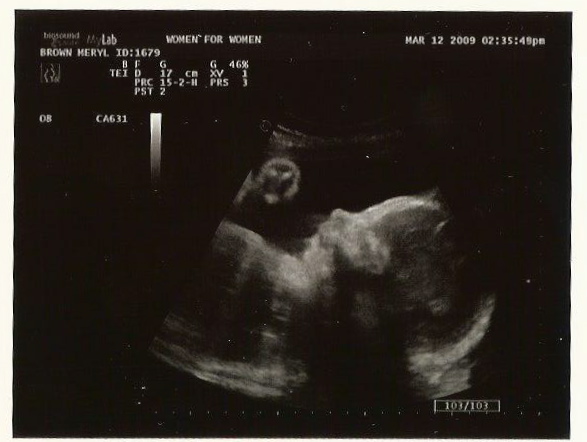 [scan_9312165716_1.jpg]