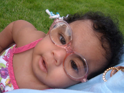 Edwards Syndrome