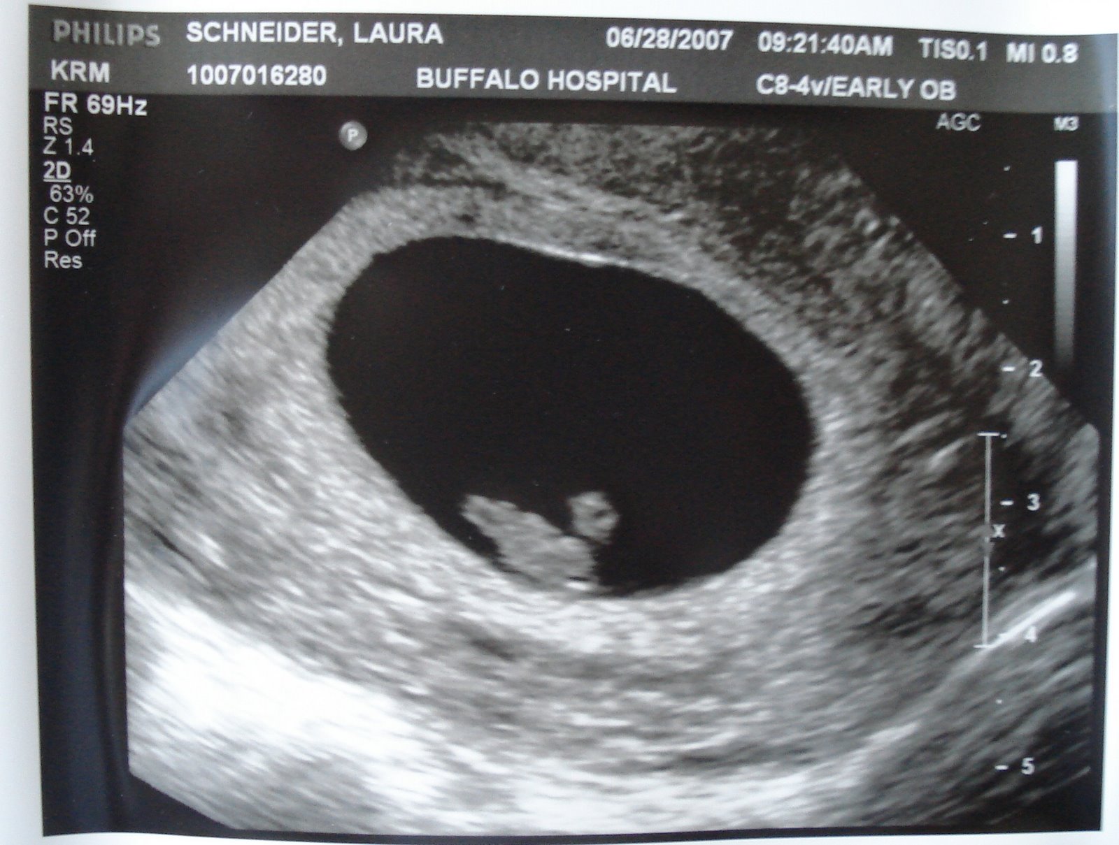 [Ultrasound+6-28-07.JPG]