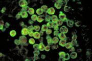 [Naegleria_fowleri.JPG]