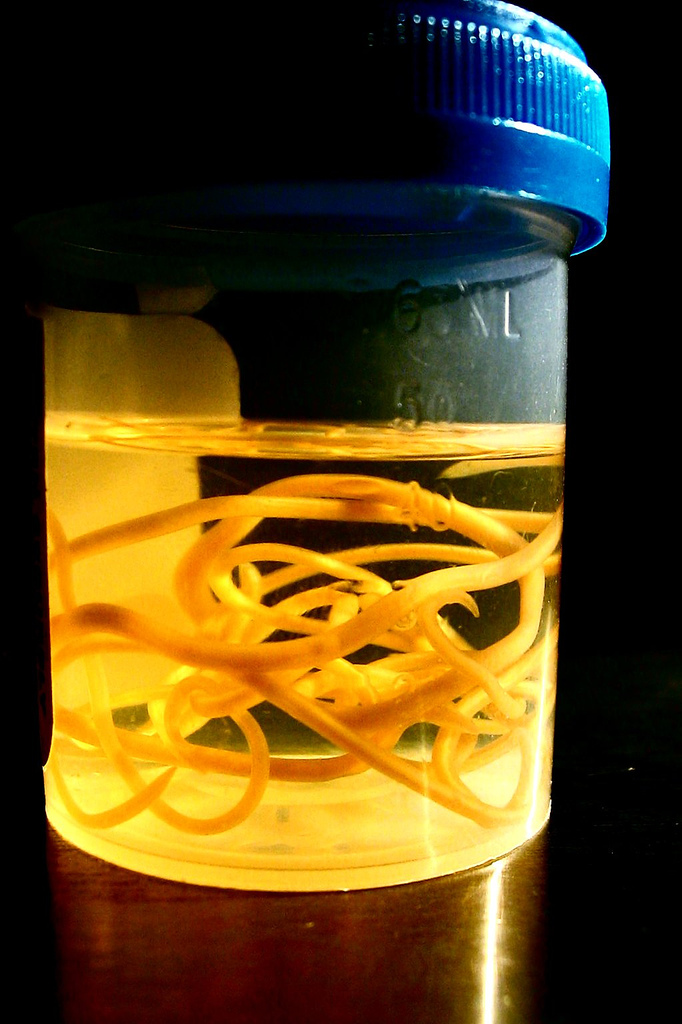 [Toxocara+Parasite.jpg]