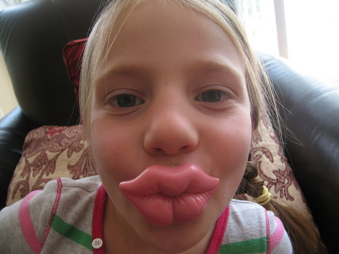 marley big lips binnie lol