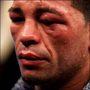 Arturo Gatti Arturo Gatti