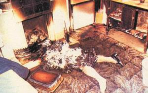 Combustion humana expontanea Combustion humana expontanea