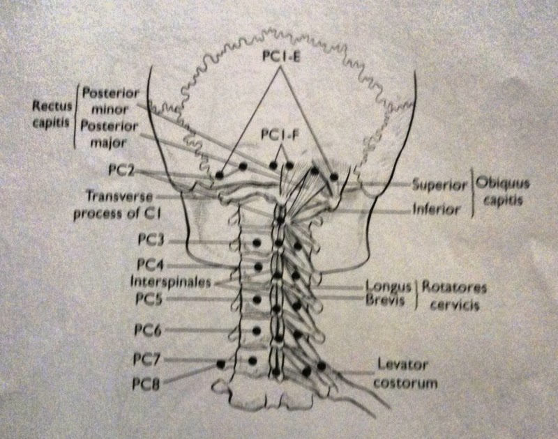 Online Osteopathic Technique Reflective Journal SCSTender Points