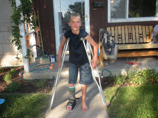 Tanner's broken leg