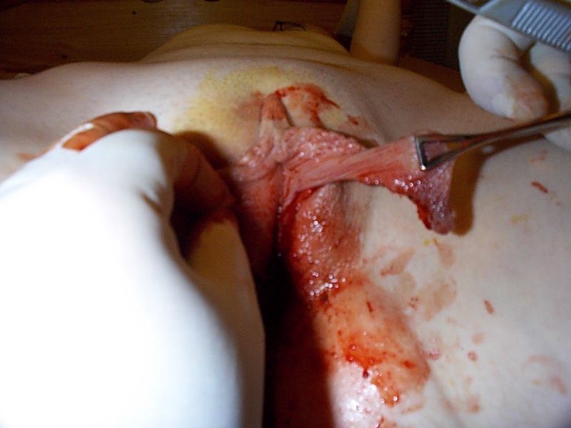 Gambar Pepek Tebal http://zonawap.net/search/v/memek%20perawan