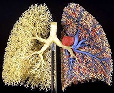 hantavirus pulmonary syndrome research paper Access to over 100,000 complete essays and term papers hantavirus pulmonary syndrome is a rodent-borne viral all papers are for research and reference. hantavirus pulmonary syndrome research paper Access to over 100,000 complete essays and term papers hantavirus pulmonary syndrome is a rodent-borne viral all papers are for research and reference.