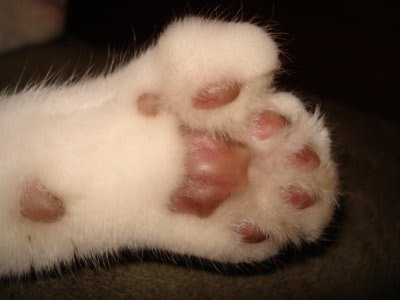 Polidactilia
