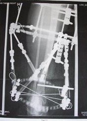 The X-ray