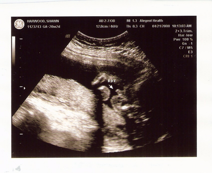 [Ultrasound+it+is+a+boy.jpg]