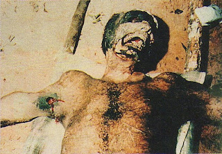 hombre mutilado en brasil (1988) por ¿Aliens? Hombre+Mutilado1