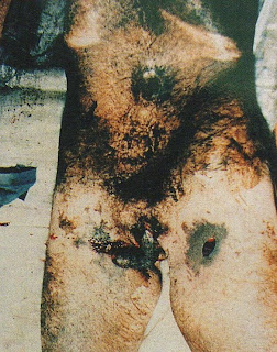 hombre mutilado en brasil (1988) por ¿Aliens? Hombre+Mutilado3