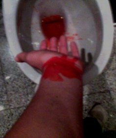 Las bañeras para los pies del hongo con la sosa