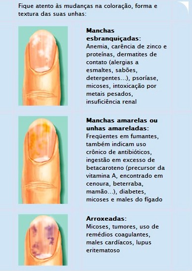 Fungo de tratamento de pregos no Israel