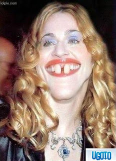 madonna_now_has_english_teeth_to_go_with_the_accent-6da.jpg