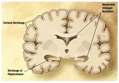 The Brains Money Changes Everything The Brains Money Changes Everything